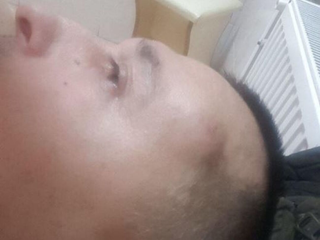 Роман Бочкала: Били молотками по голові. Цілилися в скроню. Зовсім трохи промахнулися