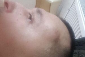 Роман Бочкала: Били молотками по голове. Метили в висок. Совсем немного промазали