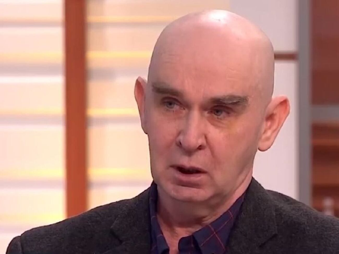 Волосы Карпичкова выпали после воздействия некоего порошка