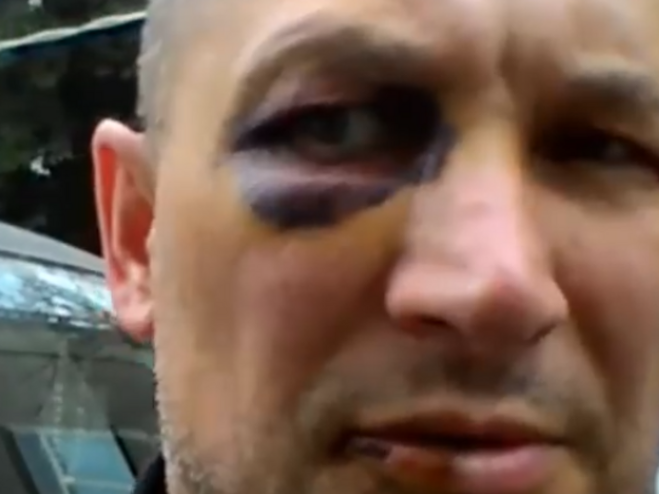 Мужчину отказались лечить в крымской больнице, так как у него нет российского паспорта