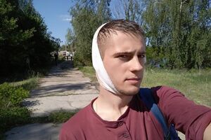 Мазилюк: Поліцейські без розбору почали бити всіх кийками