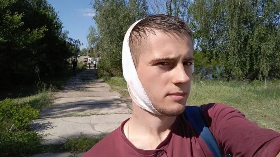Мазилюк: Полицейские без разбора принялись бить всех дубинками