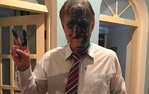 Глава Россотрудничества Воробьев после нападения в центре Киева