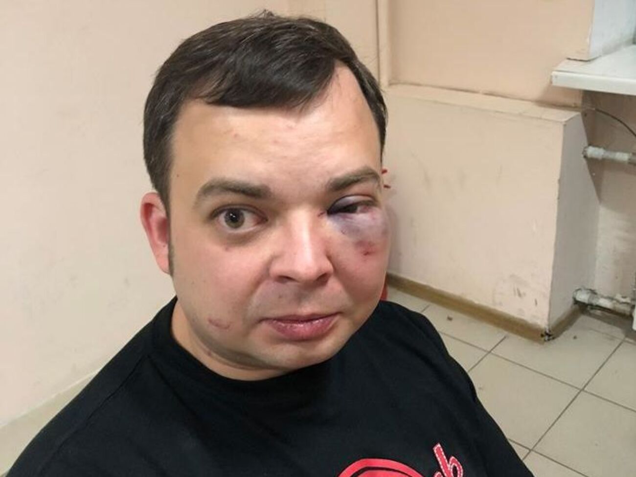 Один із приятелів Олександра Шуфрича після бійки
