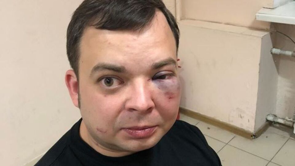 Один із приятелів Олександра Шуфрича після бійки