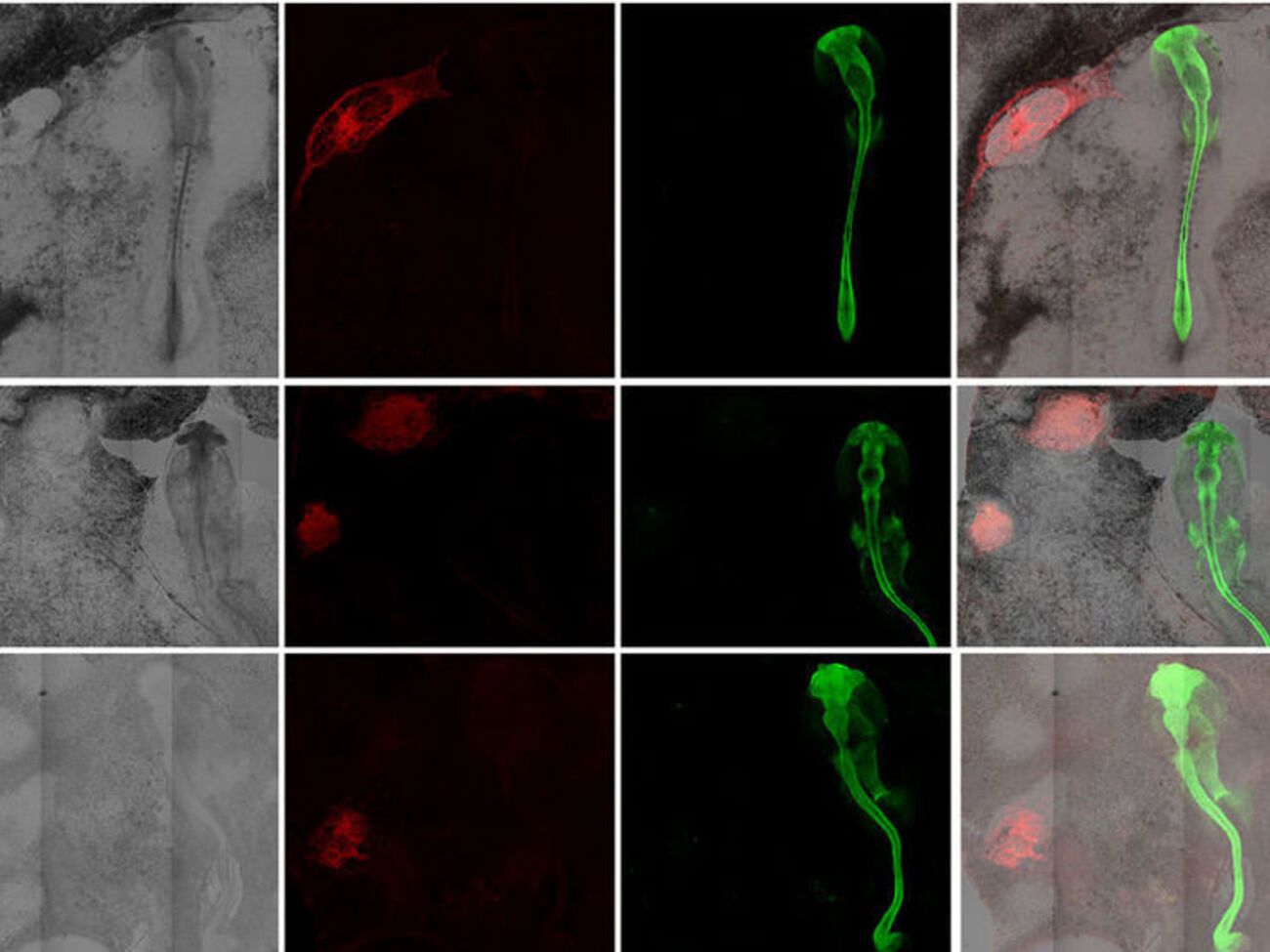 Ученые экспериментируют с человеческими клетками-организаторами, чтобы узнать больше о ранних патологиях развития