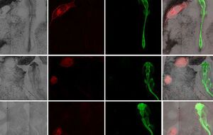 Ученые экспериментируют с человеческими клетками-организаторами, чтобы узнать больше о ранних патологиях развития