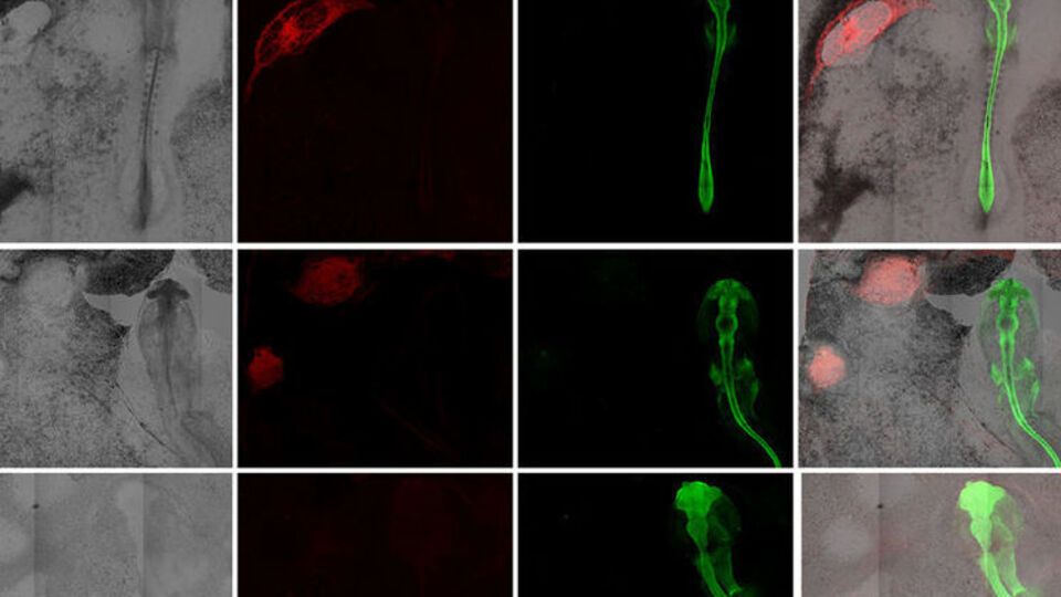 Ученые экспериментируют с человеческими клетками-организаторами, чтобы узнать больше о ранних патологиях развития