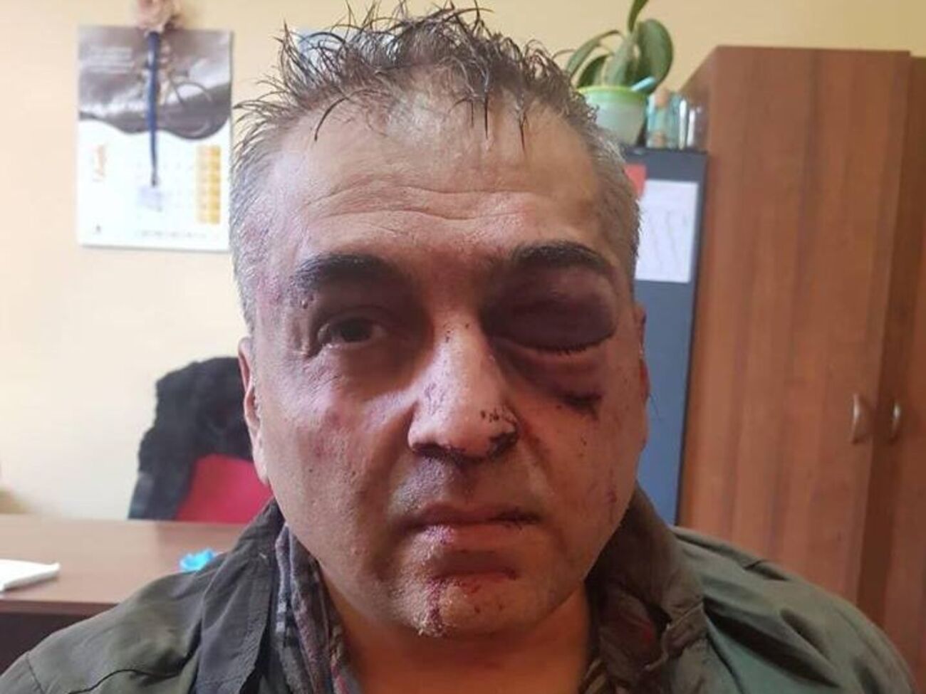 Полковник Даніелян убив людину та поранив двох під час спроби пограбувати банк, повідомили в поліції