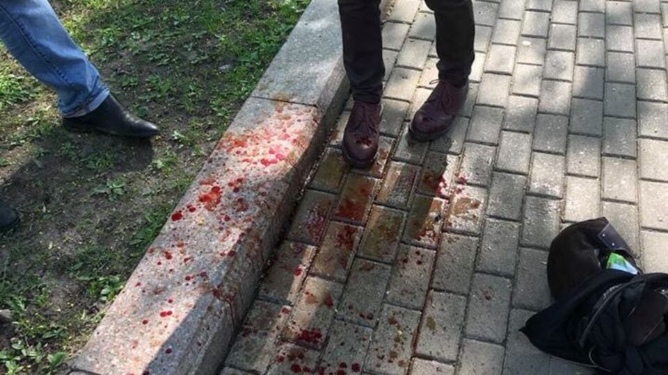 Последствия нападения "казака" на фотографа