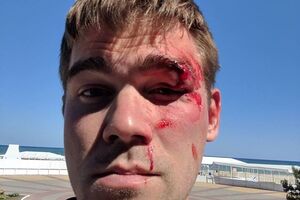 Рыбальченко обратился с заявлением в полицию