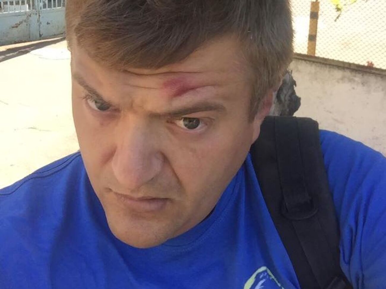 Журналіста побили двоє невідомих