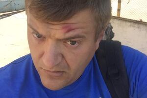 Журналіста побили двоє невідомих