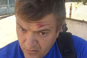 Журналіста побили 18 червня