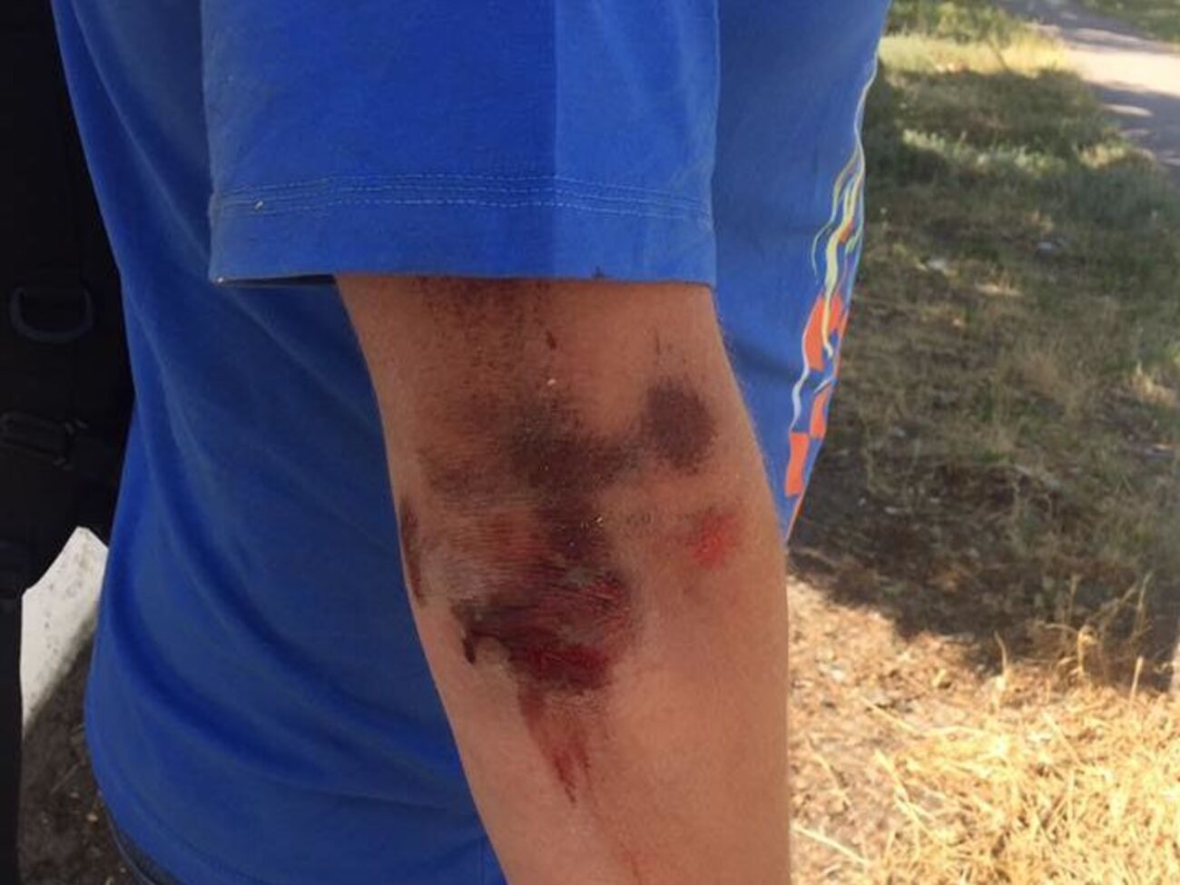 Сергій Нікітенко впізнав нападників