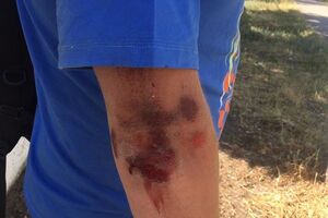 Сергій Нікітенко впізнав нападників