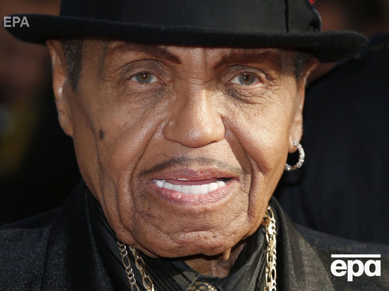 Джо Джексон боролся с онкологическим заболеванием