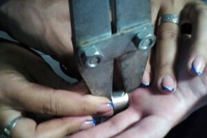 Щоб допомогти жінці зняти обручку, залучили чотирьох співробітників ДСНС
