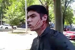 Устименко (на фото) стверджує, що нападники намагалися потрапити в ділянку нирки