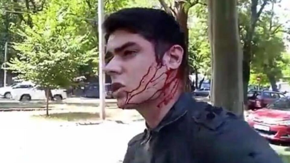 Устименко (на фото) стверджує, що нападники намагалися потрапити в ділянку нирки