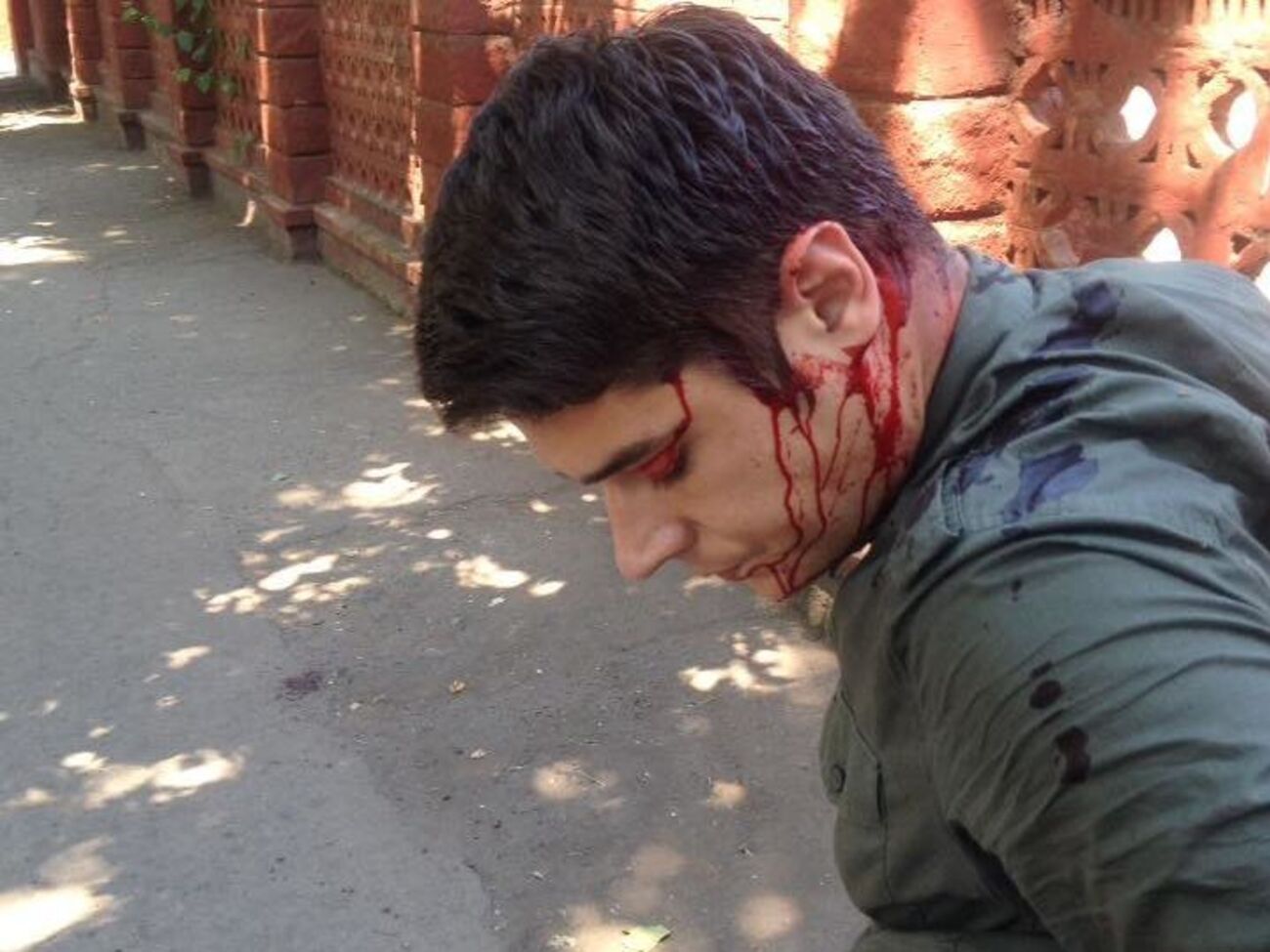 Устименко: Медики, які зашивали голову, кажуть, що поранення схожі на різані