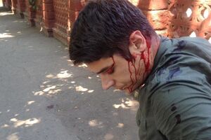 Устименко: Медики, які зашивали голову, кажуть, що поранення схожі на різані