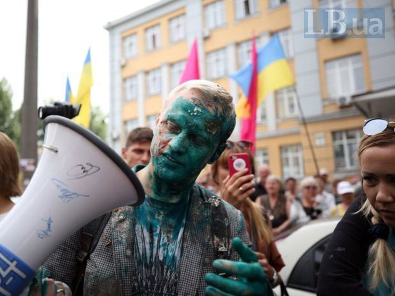 Шабунину в лицо плеснули зеленкой