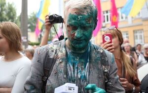 Шабунина облили зеленкой 17 июля, в ЦПК сообщили, что он получил ожоги глаз