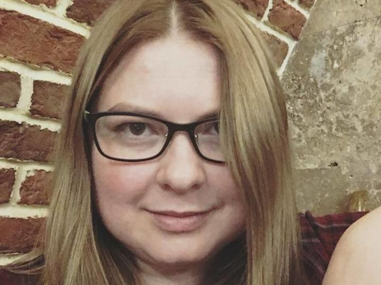 Гандзюк доставили в больницу с ожогами