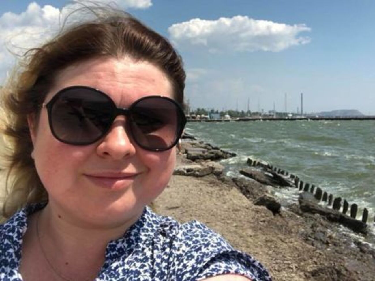 В реанимации Гандзюк провела около полутора суток