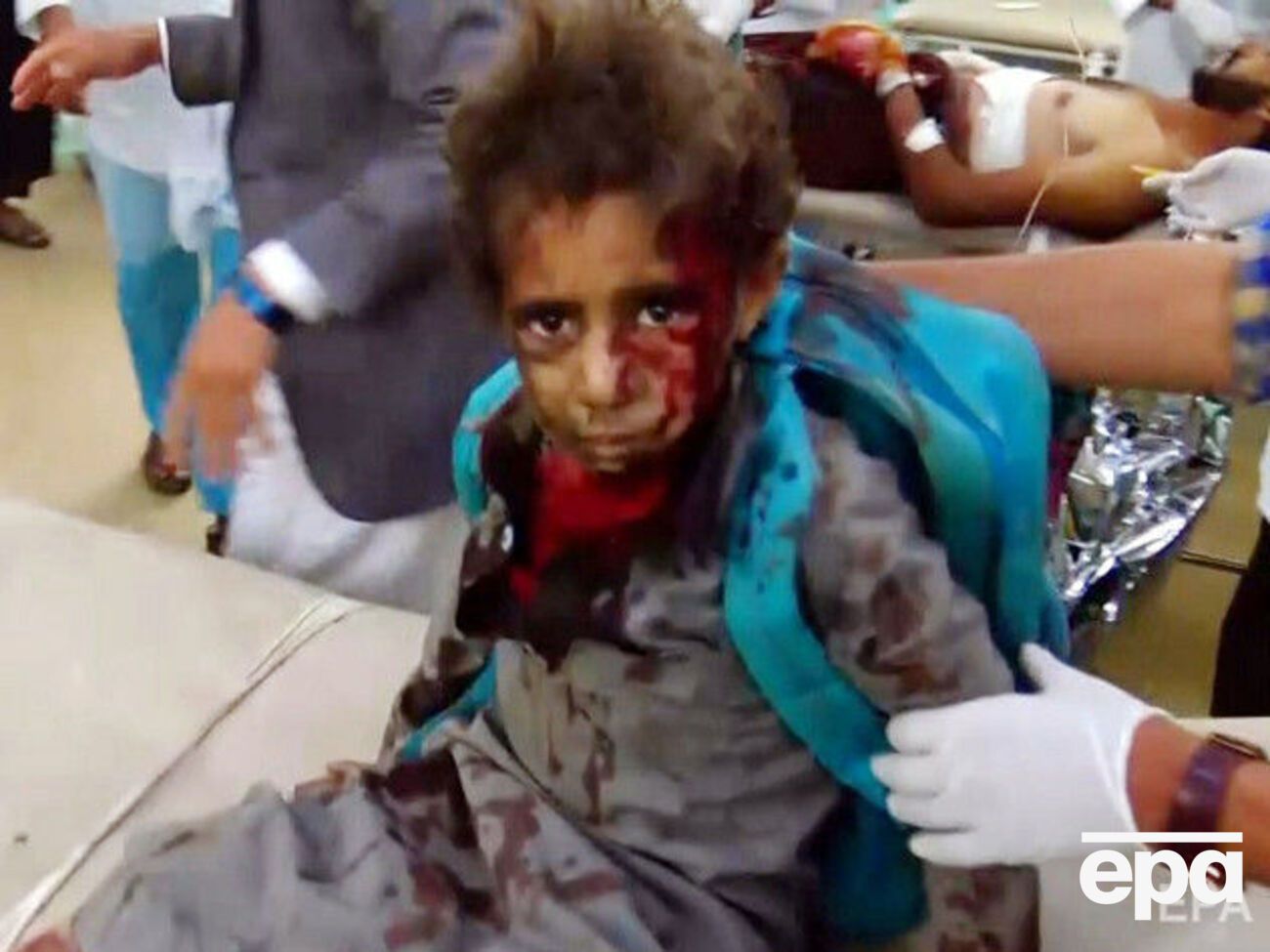 Десятки дітей постраждали внаслідок удару саудівців по Ємену