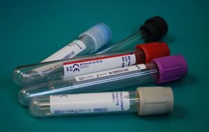 Большинство случаев ботулизма связано с употреблением рыбы