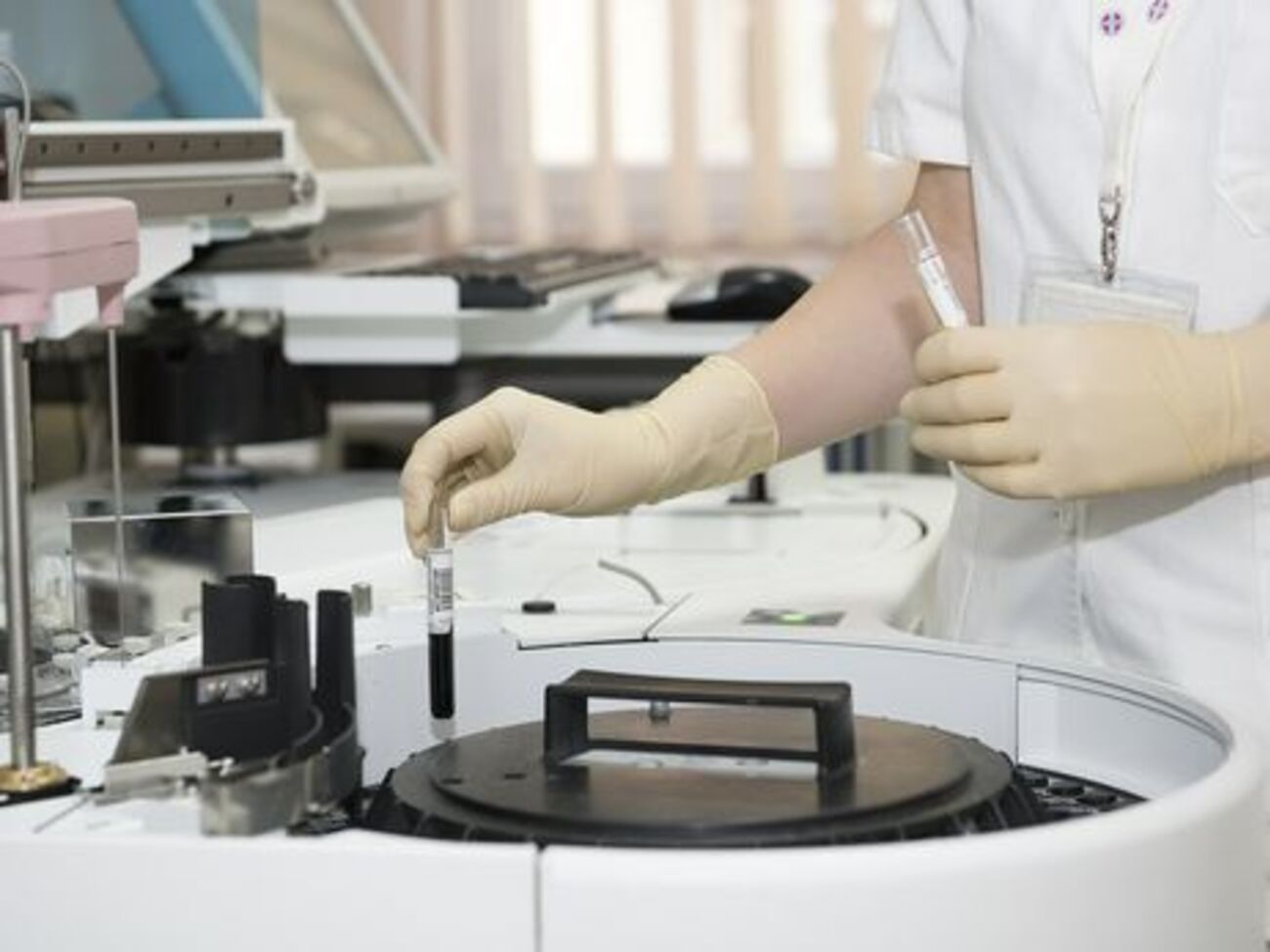 Ботулизм&nbsp;&ndash; заболевание, вызванное употреблением продуктов, содержащих ботулотоксины