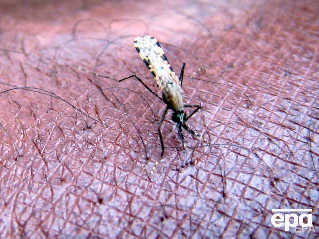 Малярия &ndash; инфекционное заболевание, которое вызывается паразитами, передающимися человеку при укусе инфицированными комарами