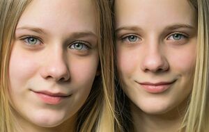 Близнецы рождаются более слабыми, чем другие дети