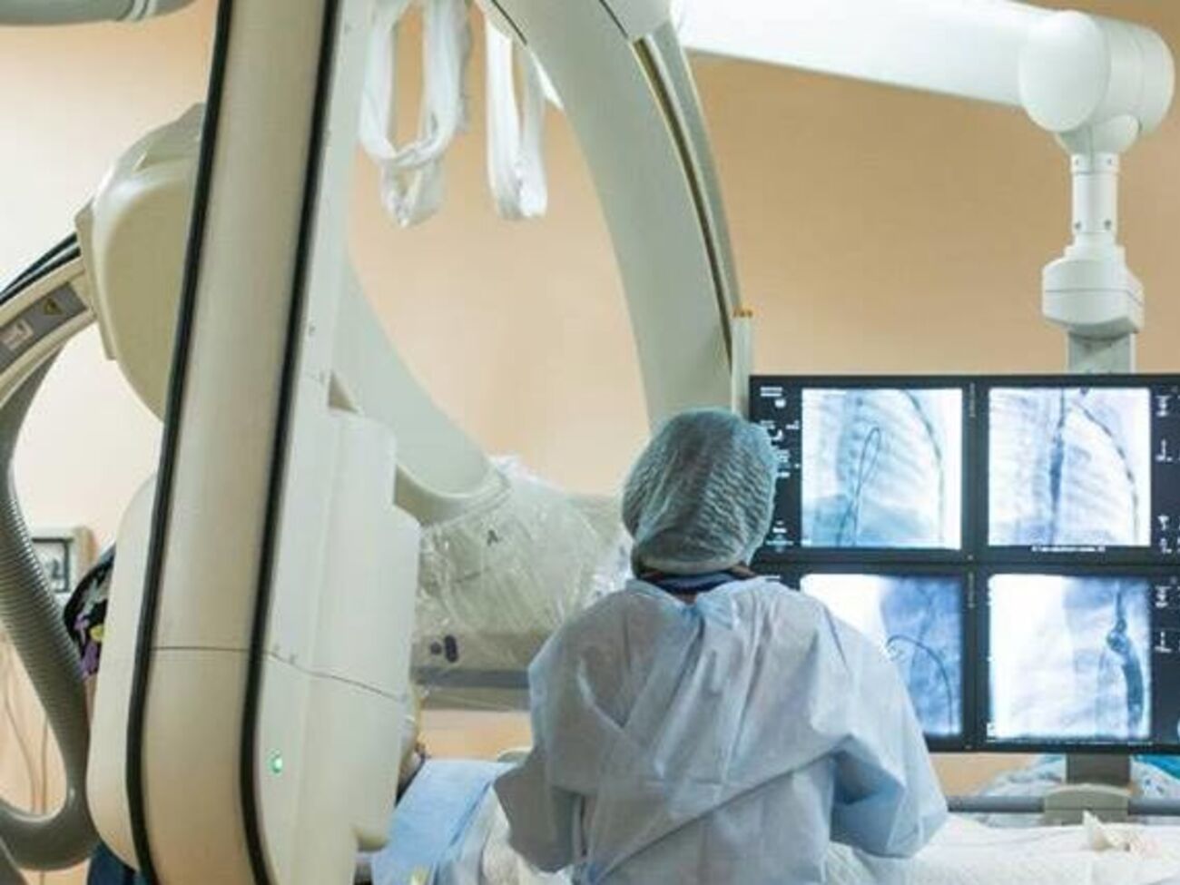 За время работы проекта "Здоровое сердце" помощь в проведении операции по установке окклюдера получили 49 детей