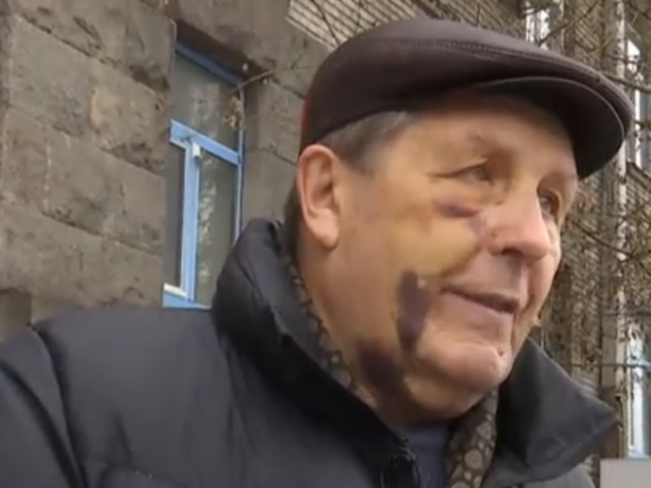 По факту избиения Ковальского правоохранители открыли уголовное производство