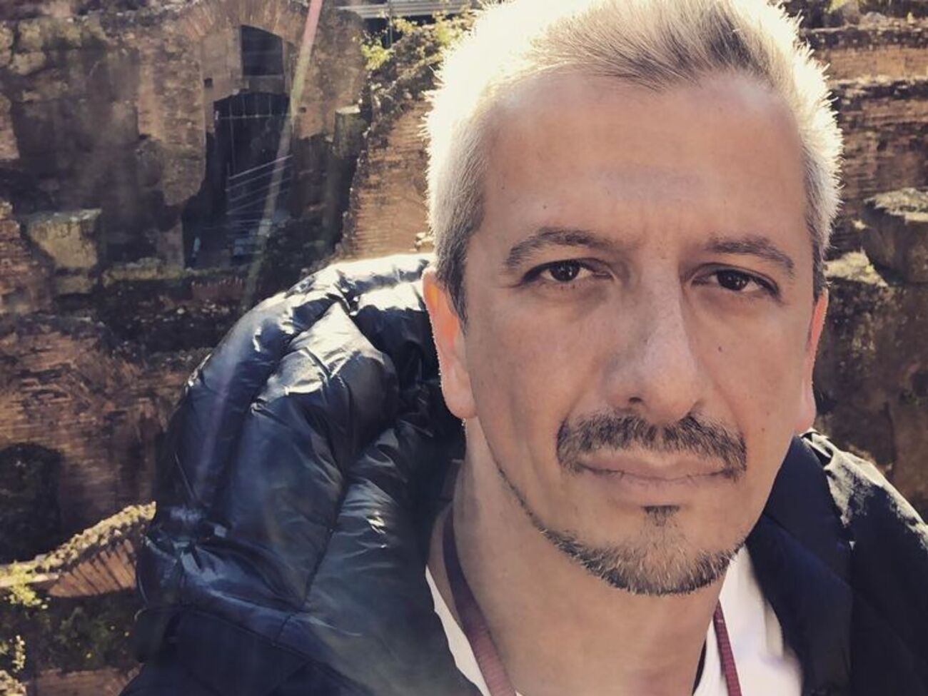 Богомолов:&nbsp;&nbsp;Врач собрал мой переломанный в двух местах нос и привел смещенные кости черепа в более-менее приличное состояние