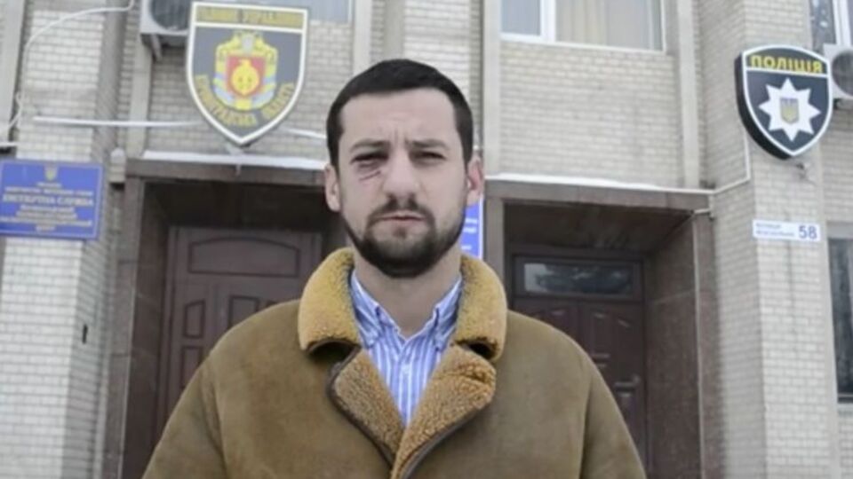 Євген Гурницький пов'язує напад на нього з професійною діяльністю