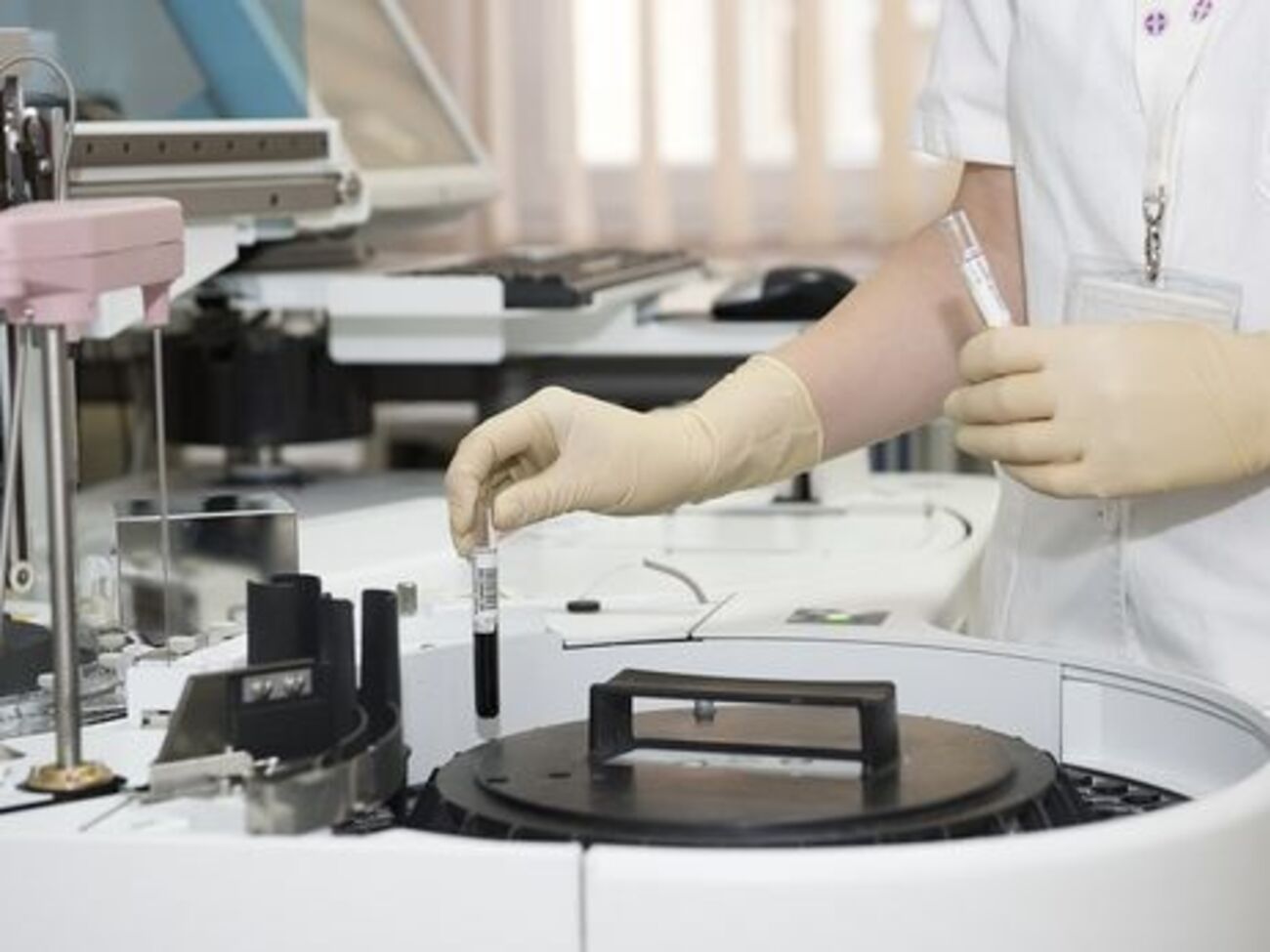 В Грузии увеличилось число случаев, когда вирус&nbsp;А(H1N1) вызывал осложнения