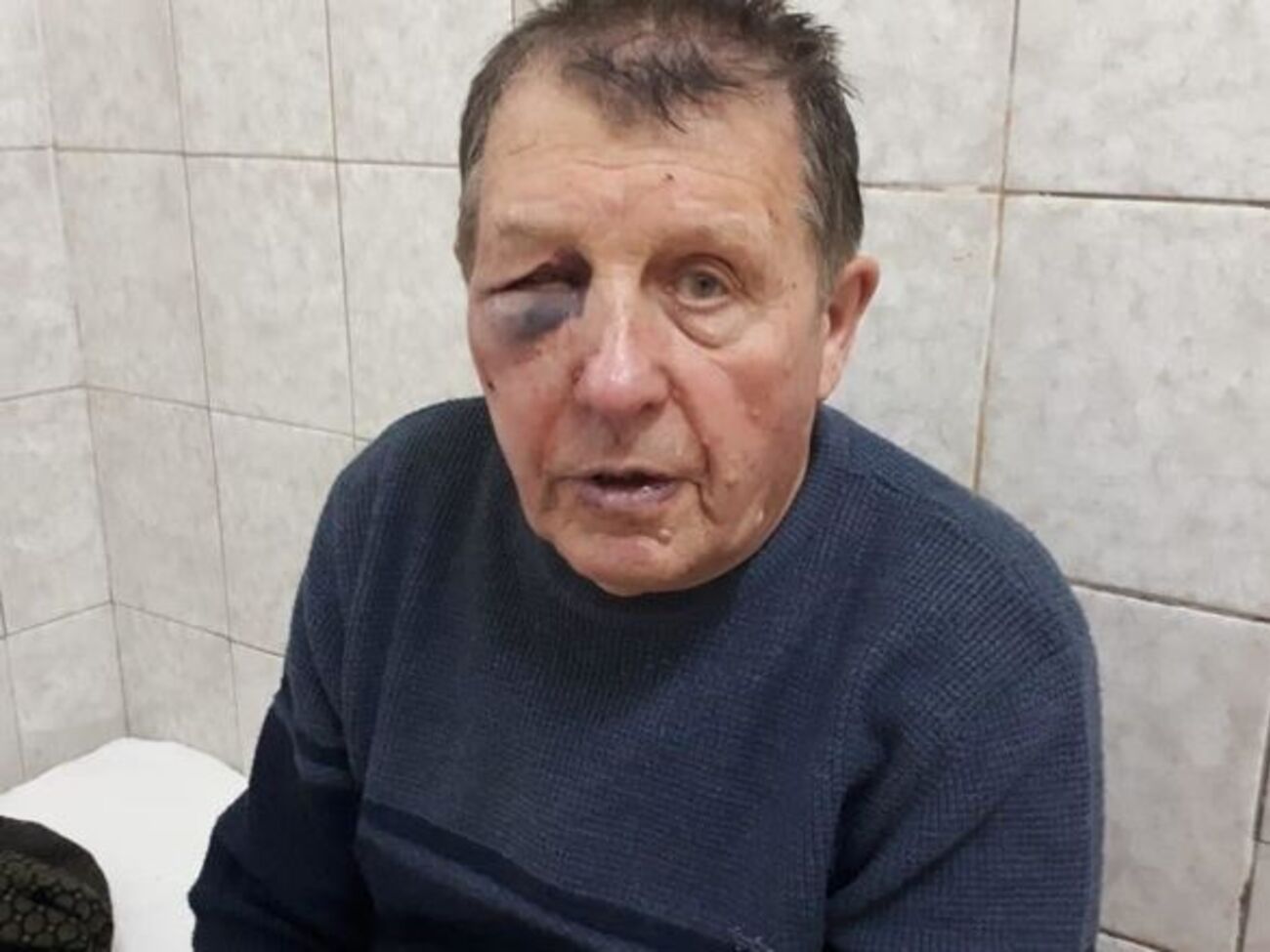 Ковальский заявил, что нападавших было пятеро, в том числе двое полицейских