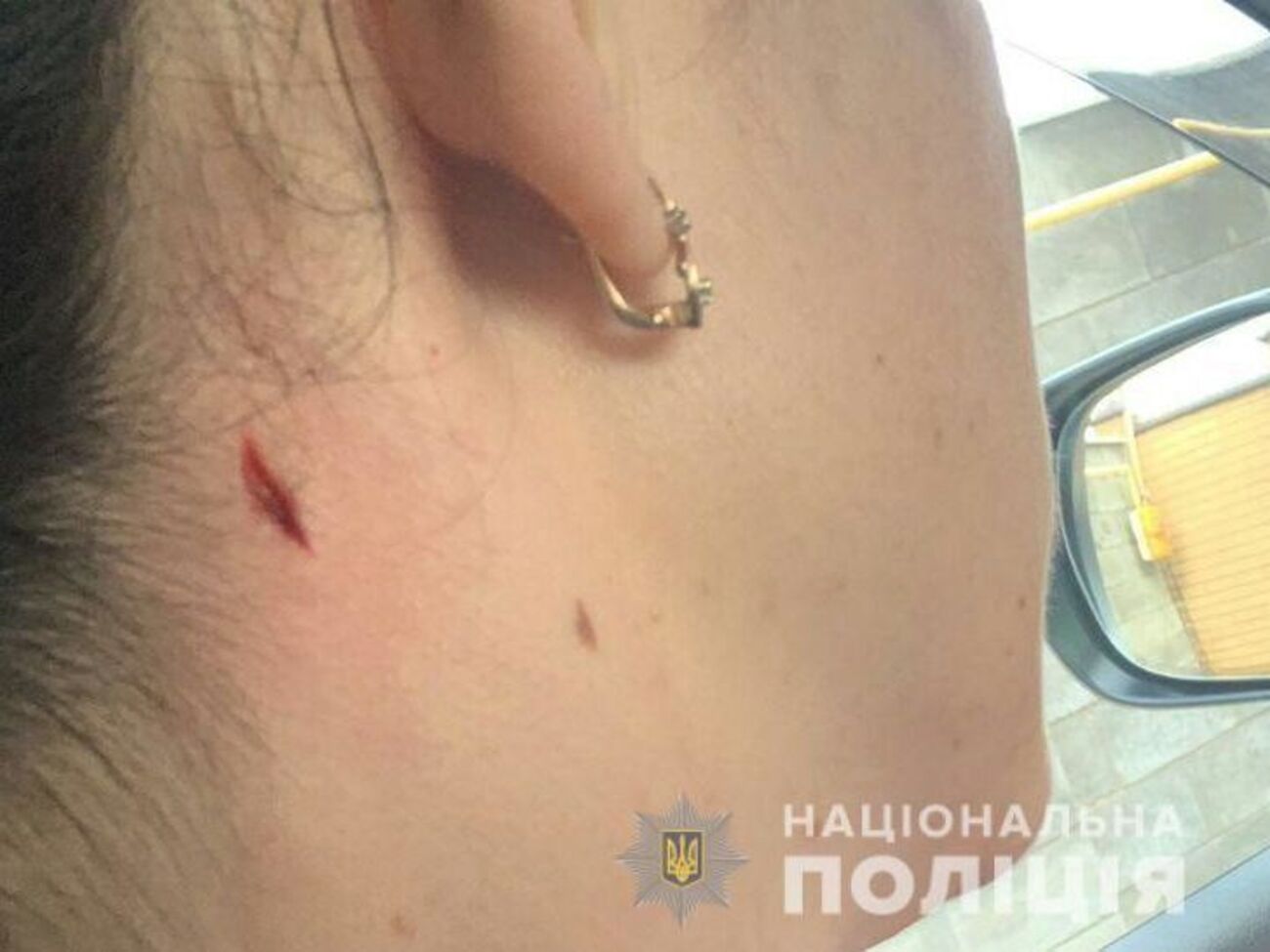 Жінка дістала поранення в ділянці шиї