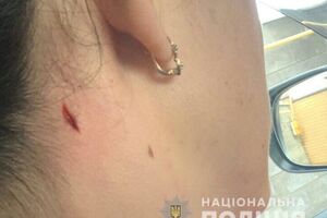 Женщина получила ранение в районе шеи