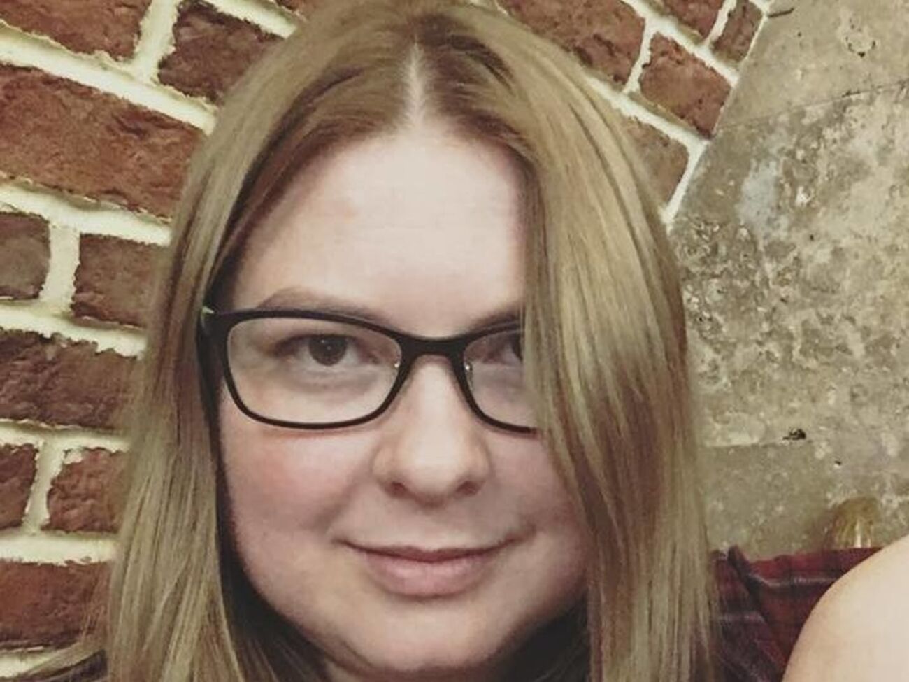 В июле 2018 года Гандзюк облили кислотой