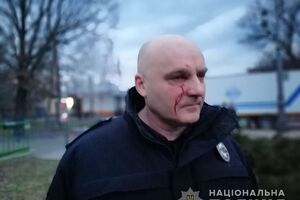 9 марта пострадал начальник полиции Черкасской области, всего 19 полицейских госпитализированы