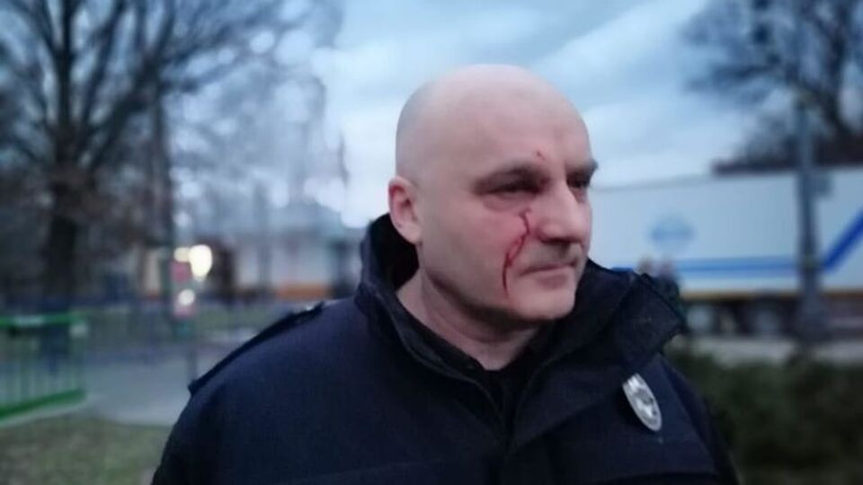 9 марта пострадал начальник полиции Черкасской области, всего 19 полицейских госпитализированы