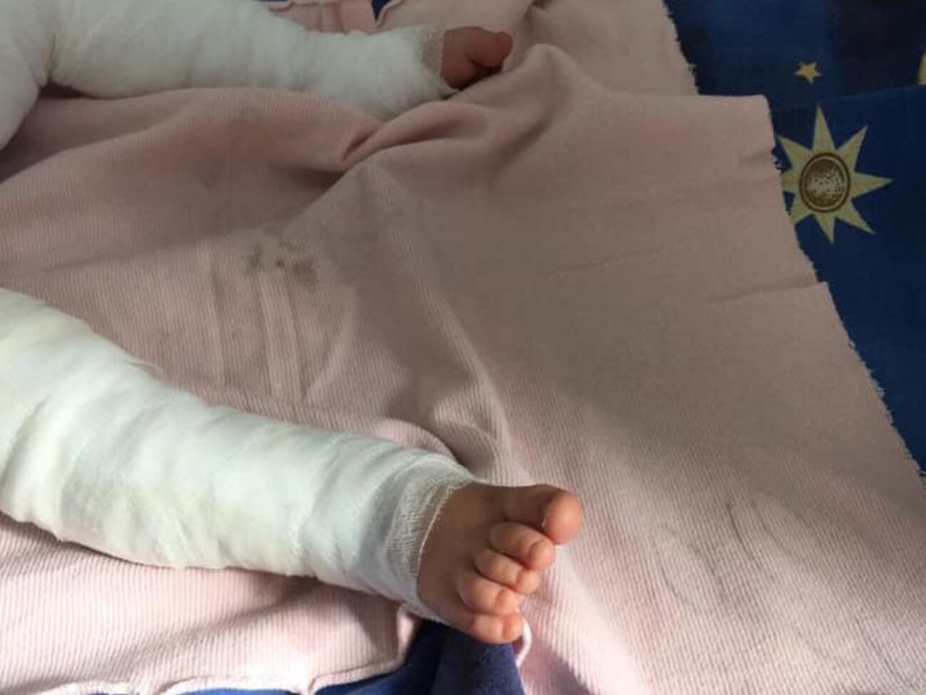 Медики називають стан дитини вкрай важким і поки не дають прогнозів