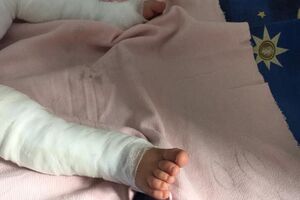 Медики называют состояние ребенка крайне тяжелым и пока не дают прогнозов