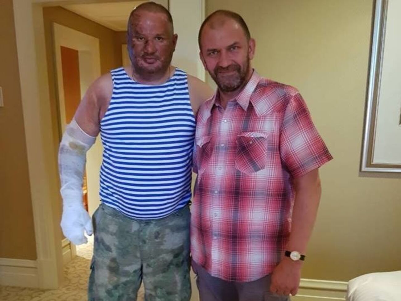 Ташкента (ліворуч) було поранено під час вибуху в донецькому кафе