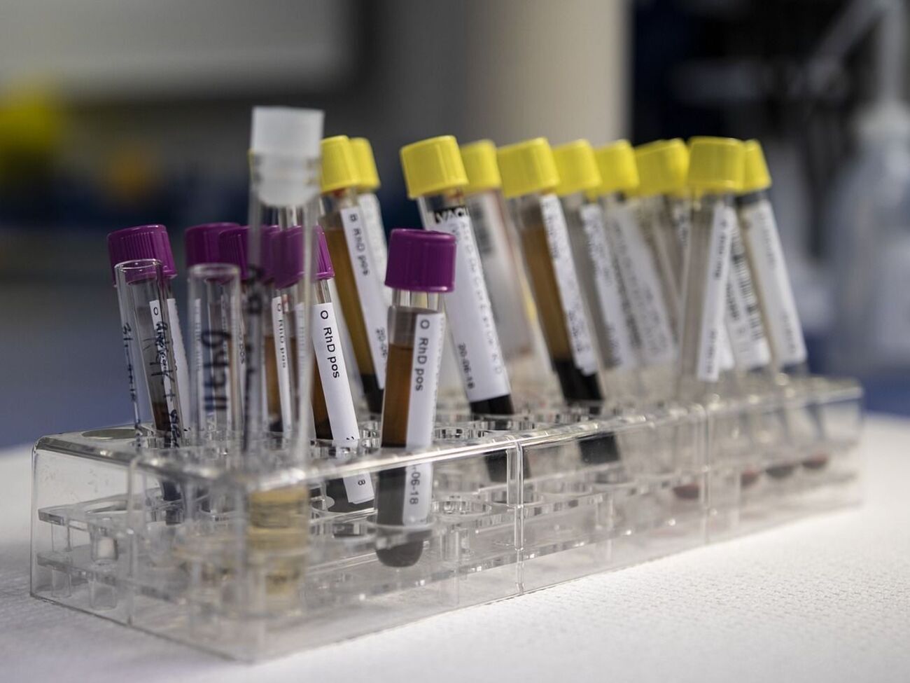 Порошенко вже здав повторний аналіз, Зеленський &ndash; ні